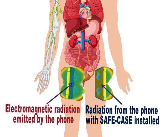 Your Pocket, Your Phone, and How to Be Smarter About Radiation